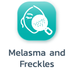Melasma and Freckles