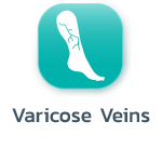 Varicose Veins