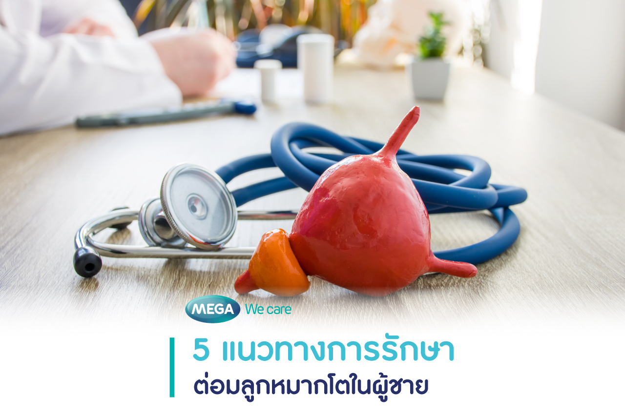 ต่อมลูกหมากโต แนวทางรักษา
