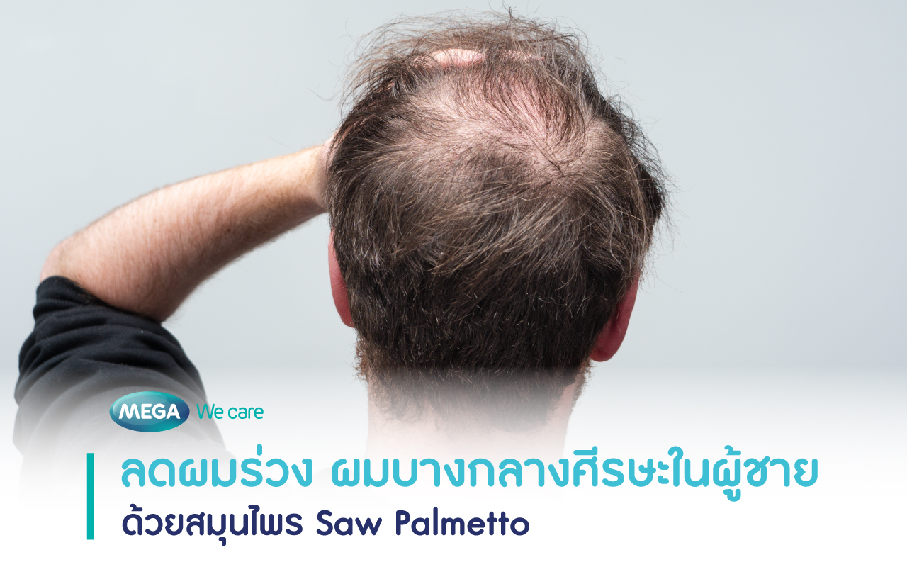 ลดผมร่วง ในผู้ชายด้วย saw palmetto