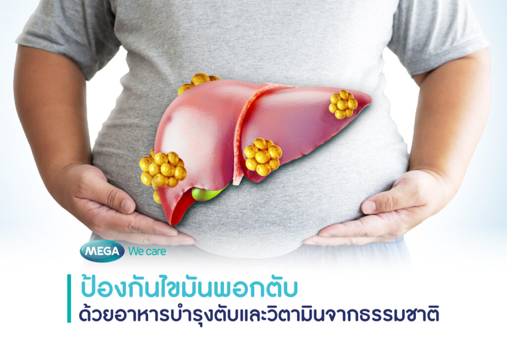 วิตามินบำรุงตับ ป้องกันไขมันพอกตับ