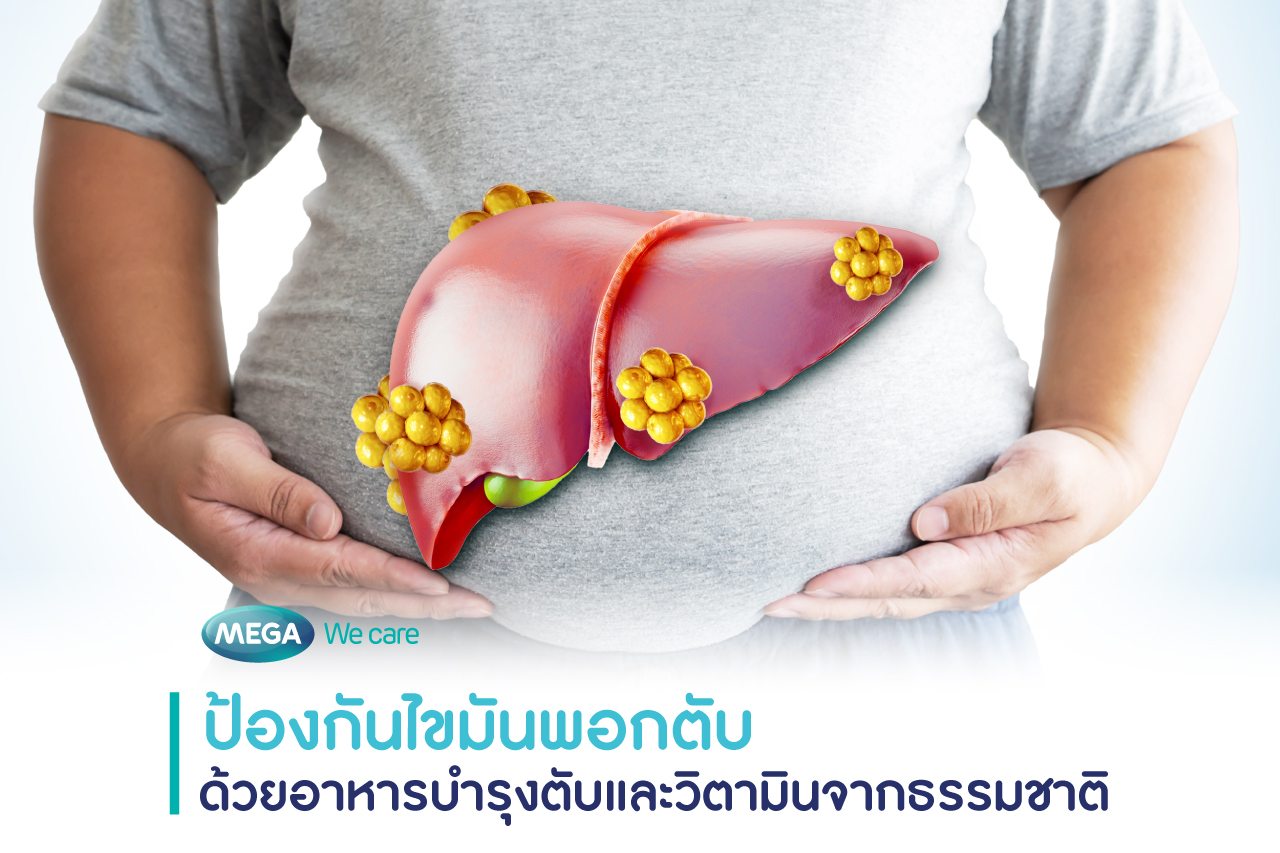 วิตามินบำรุงตับ ป้องกันไขมันพอกตับ