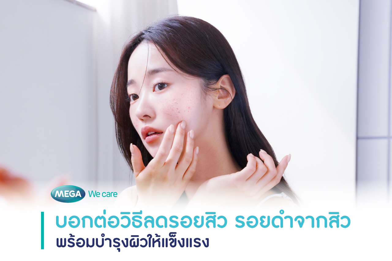 ผู้หญิงบำรุงผิว ลดรอยสิว รอยดำจากสิว