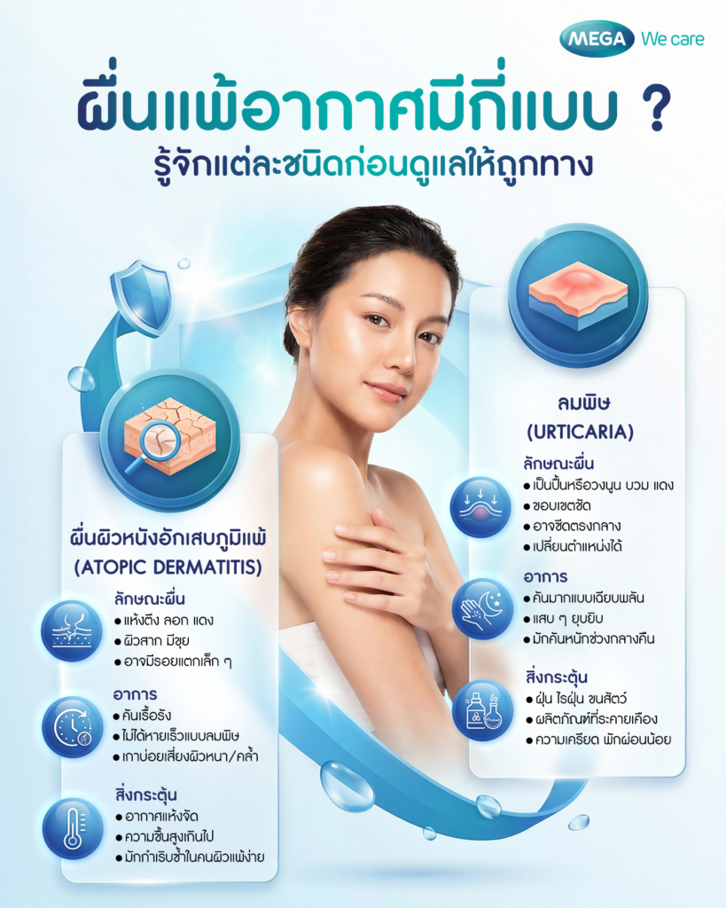 รู้จักลักษณะผื่นแพ้อากาศแต่ละประเภท