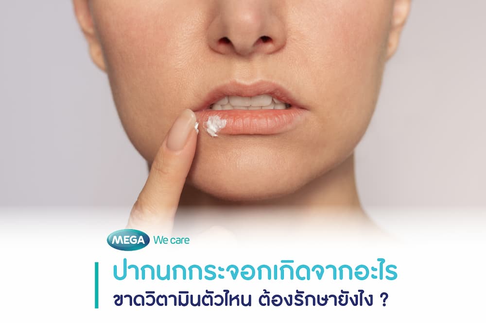 ผู้หญิงมีอาการปากนกกระจอกบริเวณมุมปากจากการขาดวิตามินบี