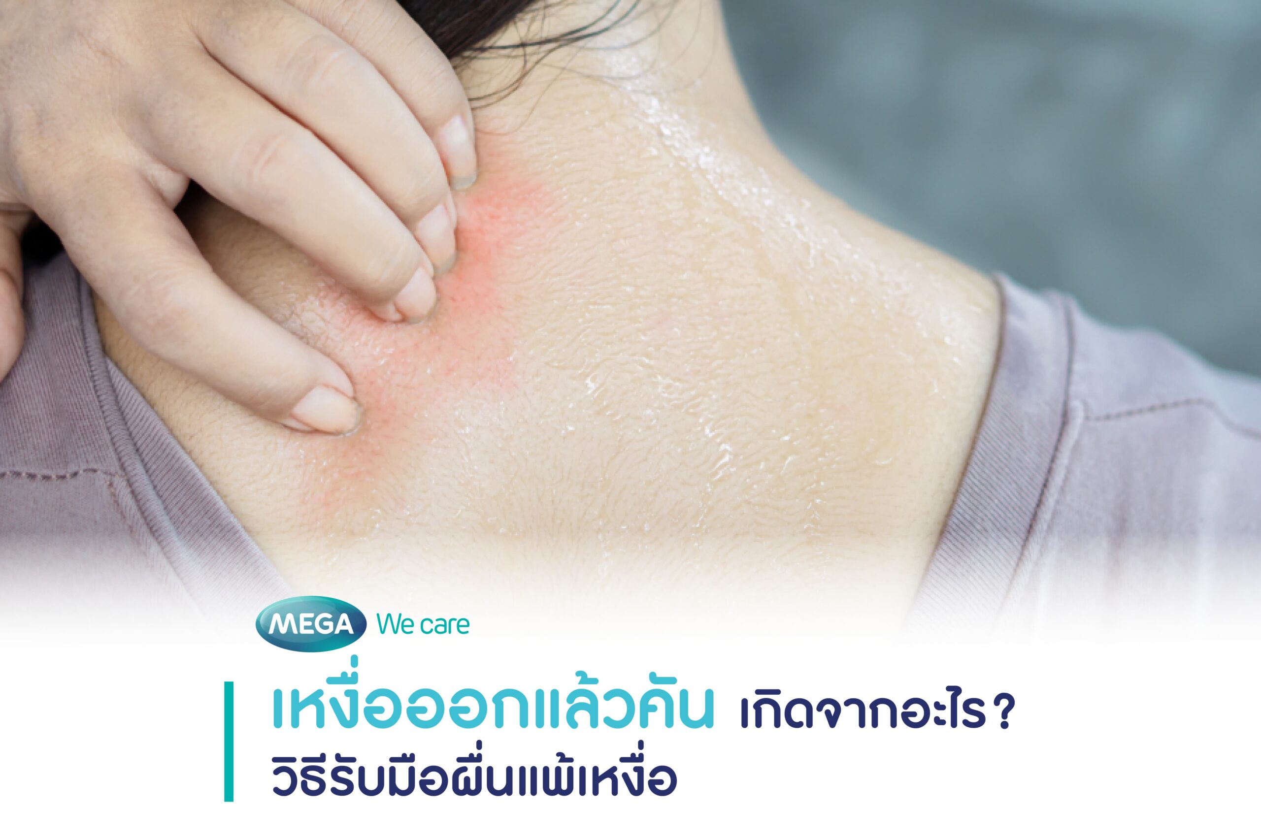 อาการแพ้เหงื่อตัวเอง เกิดผื่นแดงคันบริเวณคอ